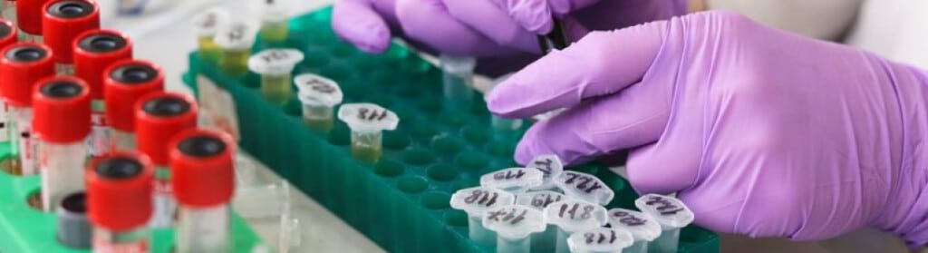 GreenLab, Inc. has developed a plant-powered breakthrough to fight pollution. U.S. Patent Application No. 20250161732, titled ‘Compositions and methods for degradation of pollutants by plant-produced manganese peroxidase’, outlines a system that uses corn to produce a powerful cleanup enzyme.